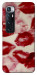 Чехол Kisses для Xiaomi Mi 10 Ultra