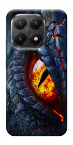 Чохол Snake eye для Xiaomi 15T