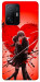 Чехол Dramatic couple для Xiaomi 11T