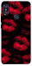 Чехол Kisses on black для Xiaomi Redmi Note 5 (Dual Camera)