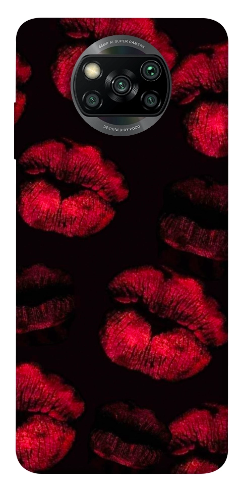 Чохол Kisses on black для Xiaomi Poco X3 NFC