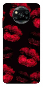 Чохол Kisses on black для Xiaomi Poco X3 NFC