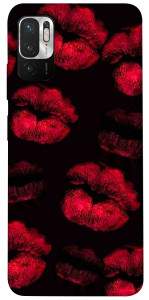 Чехол Kisses on black для Xiaomi Redmi Note 10 5G