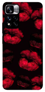 Чехол Kisses on black для Xiaomi Redmi Note 11 5G