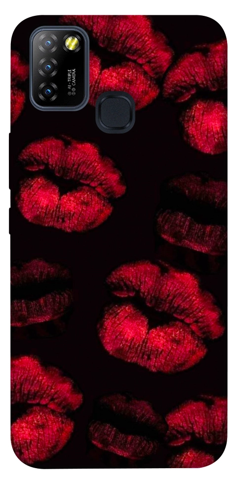 Чехол Kisses on black для Infinix Hot 10 Lite