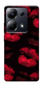 Чехол Kisses on black для Xiaomi Poco M6