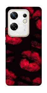 Чехол Kisses on black для Infinix Zero 30 4G