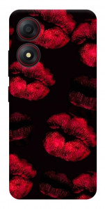 Чохол Kisses on black для ZTE Blade A34 4G