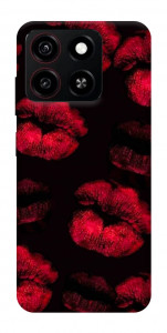 Чохол Kisses on black для ZTE Blade A35 4G