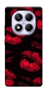 Чохол Kisses on black для Xiaomi Redmi Note 14 Pro 4G