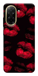 Чохол Kisses on black для Xiaomi Redmi A5 (Europe version)