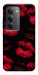 Чехол Kisses on black для Xiaomi Redmi 15 (Europe version)