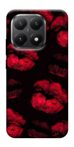 Чохол Kisses on black для Xiaomi 15T
