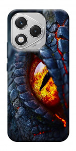 Чохол Snake eye для Huawei Honor 400 Lite