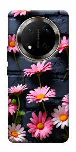 Чохол Рожевий контраст для Huawei Honor X9c