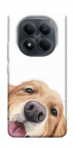 Чохол Funny dog для Xiaomi Redmi Note 15 Pro 4G