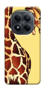 Чохол Cool giraffe для Xiaomi Redmi Note 15 Pro 4G