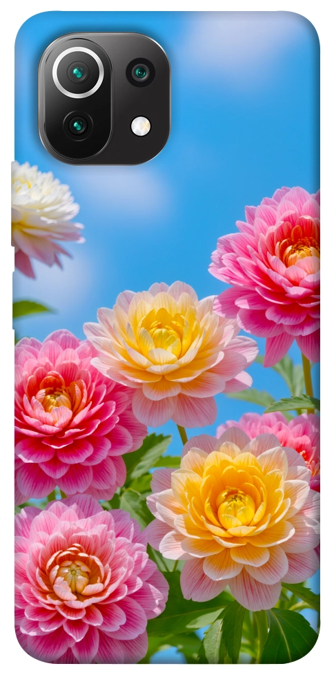 Чохол Summer day для Xiaomi Mi 11 Lite