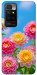 Чехол Summer day для Xiaomi Redmi 10
