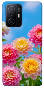 Чохол Summer day для Xiaomi 11T