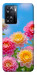 Чехол Summer day для OnePlus Nord N20 SE