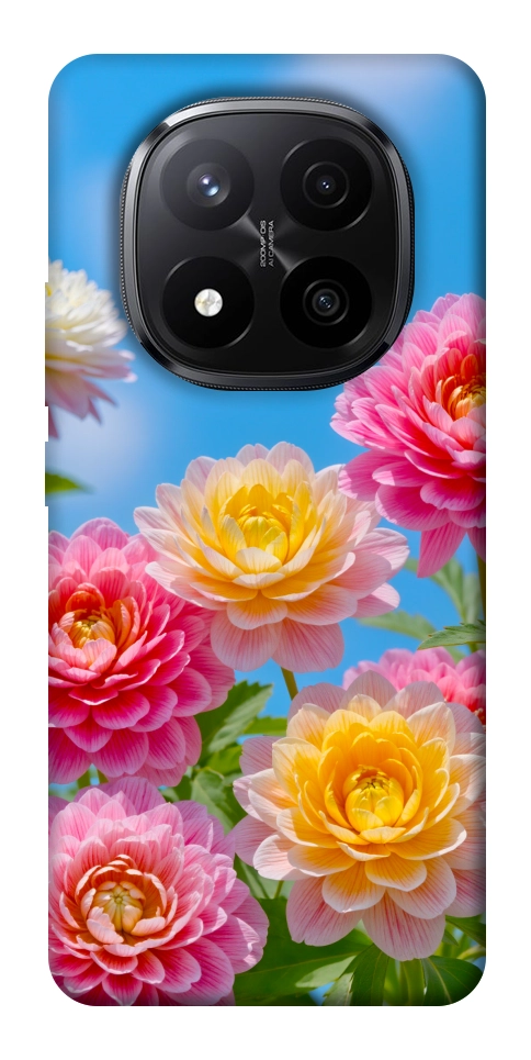 Чехол Summer day для Xiaomi Redmi Note 14 Pro+ 5G