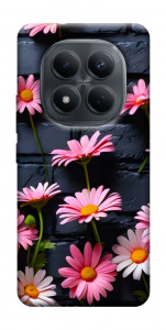 Чехол Розовый контраст для Xiaomi Redmi Note 15 4G (EU)