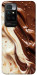 Чехол Chocolat combo для Xiaomi Redmi 10
