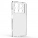 TPU чехол Epic Transparent 1,5mm Full Camera для Infinix Note 40 4G (Бесцветный (прозрачный))