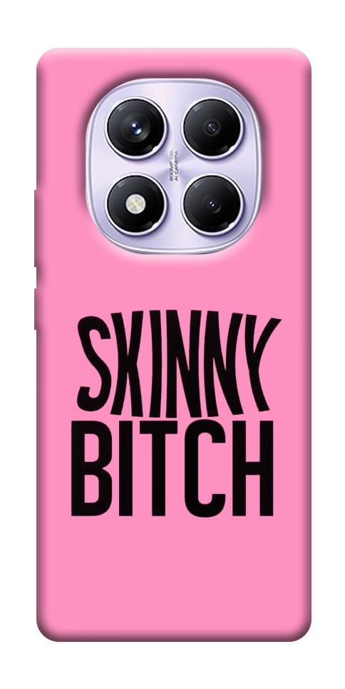 Чехол Skinny для Xiaomi Poco X7