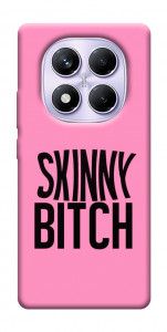 Чехол Skinny для Xiaomi Poco X7