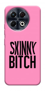 Чехол Skinny для TECNO Spark 30 Pro (KL7)