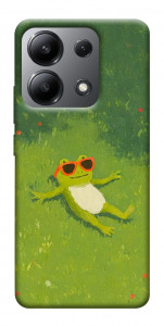 Чехол Лягушачий chill для Xiaomi Redmi Note 13 4G
