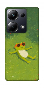 Чехол Лягушачий chill для Xiaomi Poco M6 Pro 4G