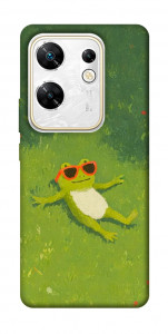 Чехол Лягушачий chill для Infinix Zero 30 4G