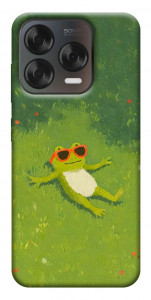 Чехол Лягушачий chill для ZTE Nubia V70 Design