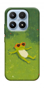 Чохол Жаб'ячий chill для Xiaomi 17