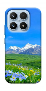 Чохол Summer landscape для Xiaomi 17