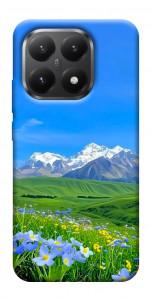 Чехол Summer landscape для Xiaomi 15T