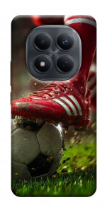 Чохол Сlose up football для Xiaomi Redmi Note 15 Pro 4G