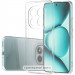 TPU чехол Epic Transparent 1,5mm Full Camera для Xiaomi Redmi Note 17 Pro (Бесцветный (прозрачный))