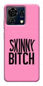 Чохол Skinny для ZTE Blade V50 Vita