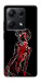 Чохол Rei skeleton для Xiaomi Redmi Note 14S