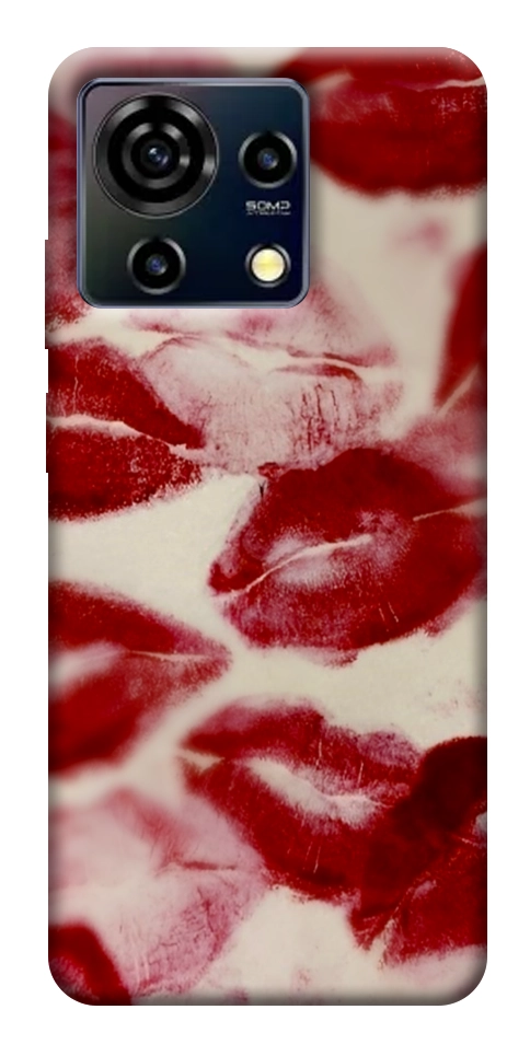 Чохол Kisses для ZTE Blade V50 Vita