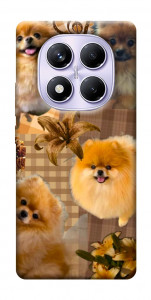 Чехол Spitz aethtetic для Xiaomi Poco X7