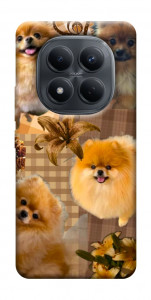 Чехол Spitz aethtetic для Xiaomi Redmi Note 15 4G (EU)