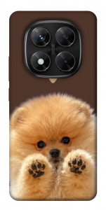 Чехол Spitz on the screen для Xiaomi Redmi Note 14 Pro 5G