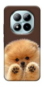 Чехол Spitz on the screen для Xiaomi Redmi Note 15 Pro 5G