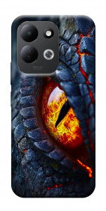 Чохол Snake eye для Xiaomi Redmi 17