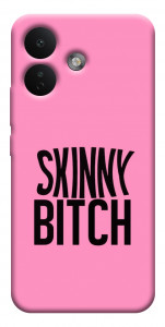 Чехол Skinny для Xiaomi Redmi Note 17 Pro